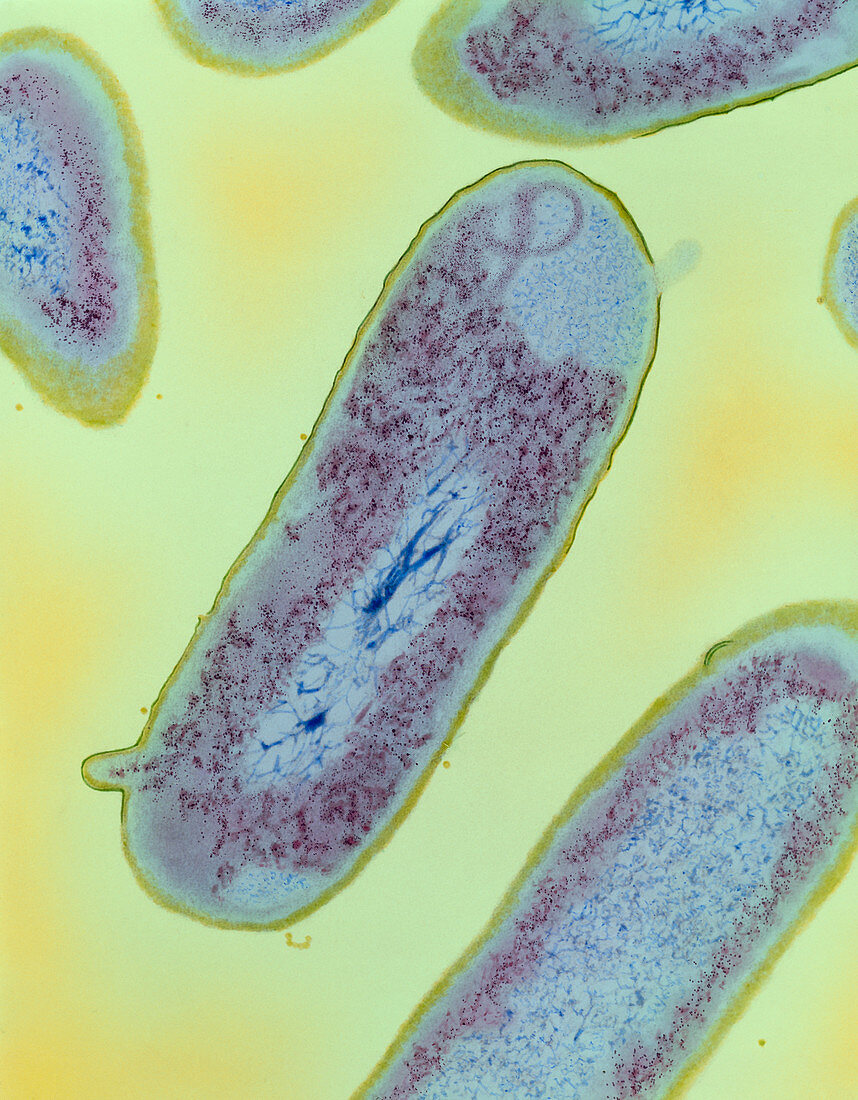 Shigella dysenteriae type 1 bacteria