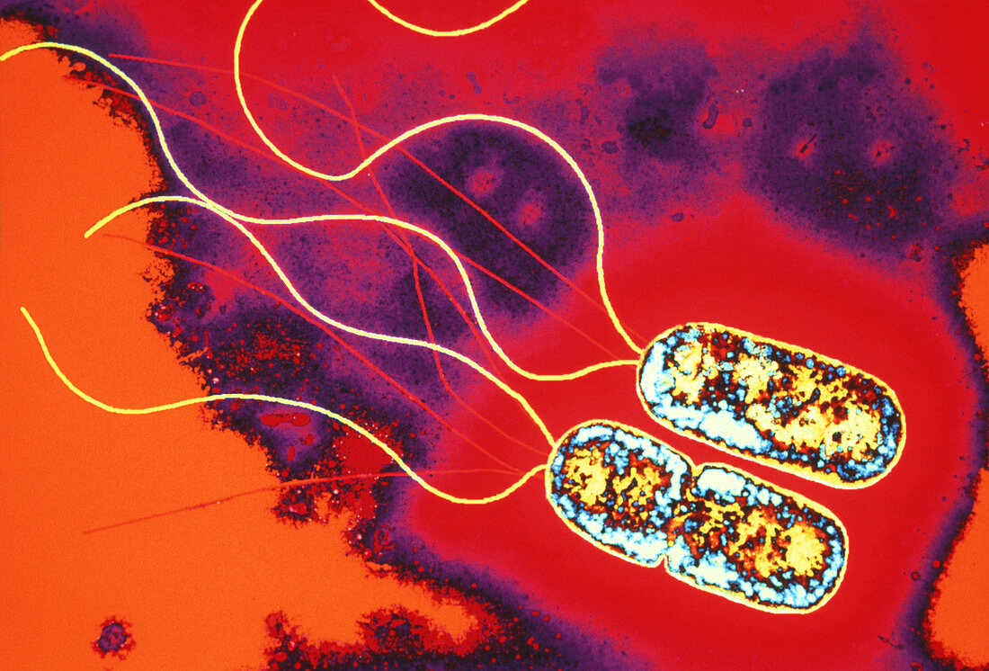 Pseudomonas sp. bacteria,TEM