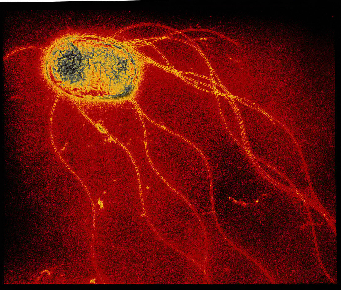 Salmonella enteritidis bacterium