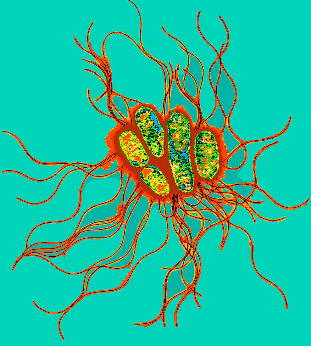 TEM of Salmonella bacteria