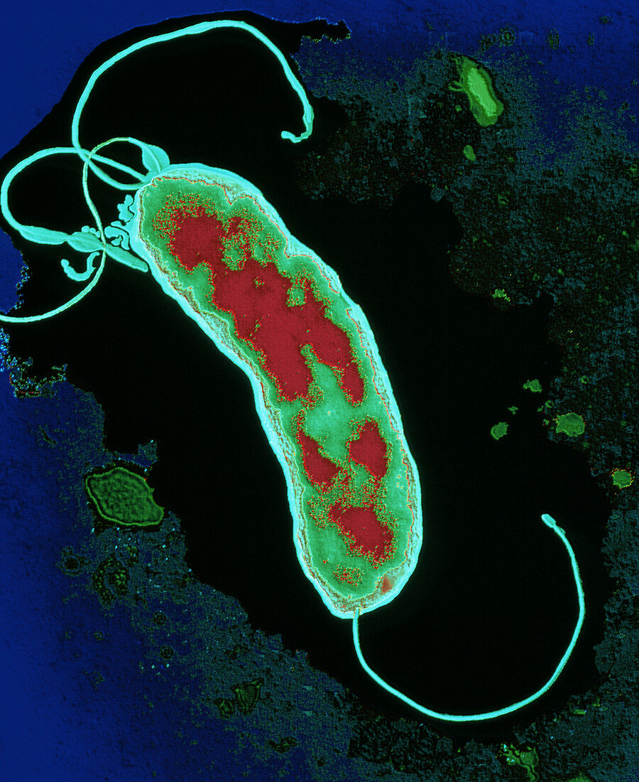 CHelicobacter pylori bacterium