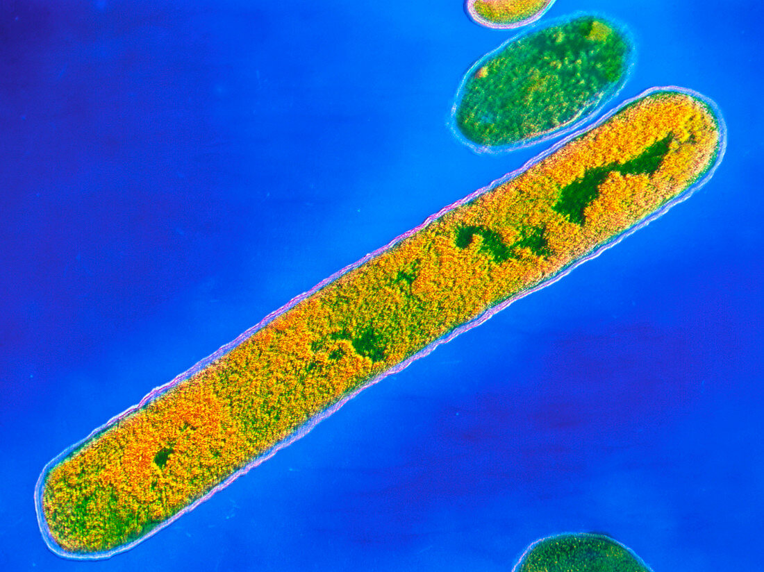 TEM of Clostridium tetani bacterium