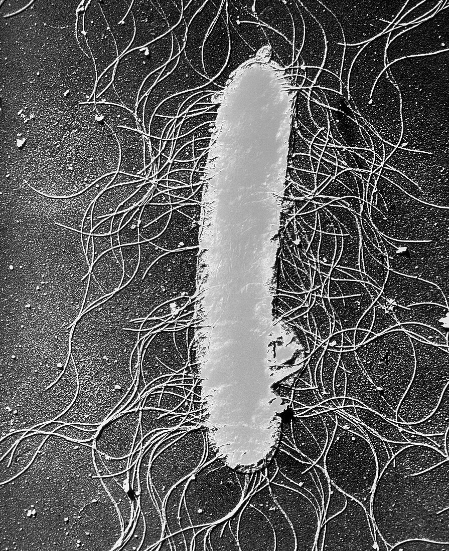 TEM of the bacteria,Proteus mirabilis