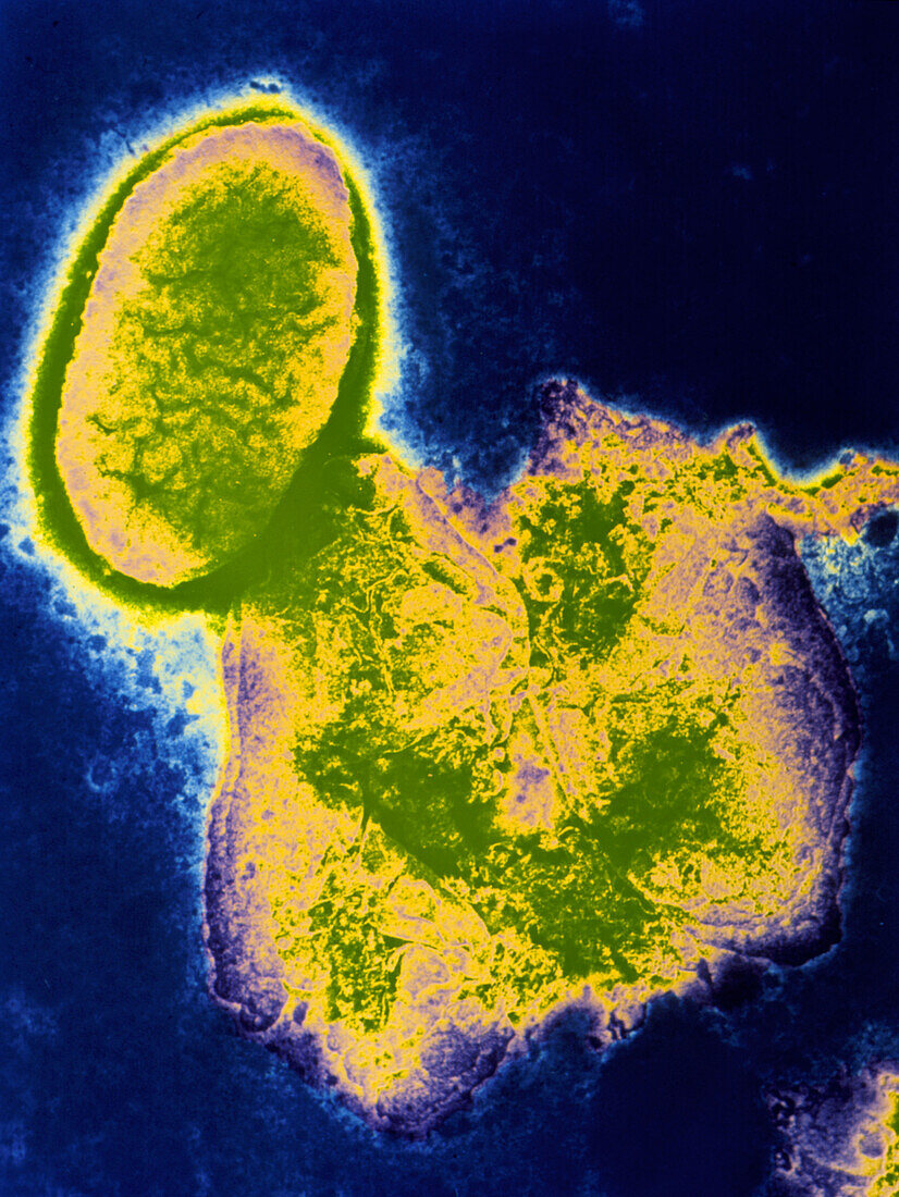 Haemophilus influenzae bacterium