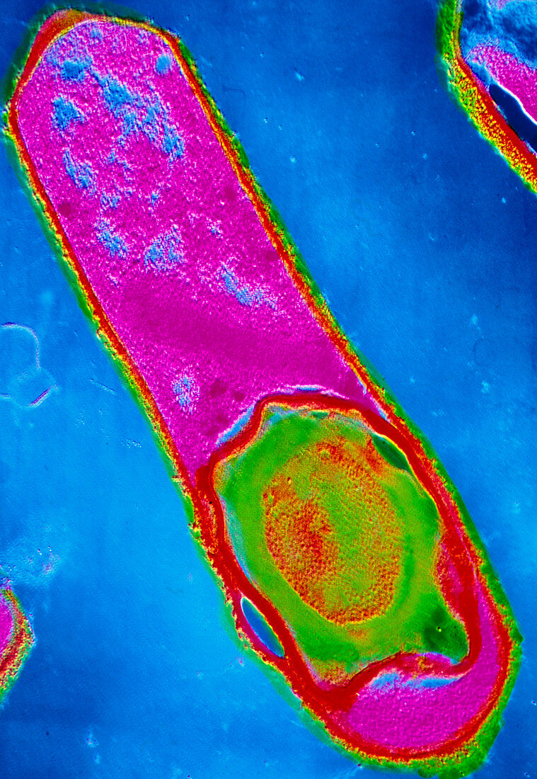 Clostridium perfringens bacterium with spore