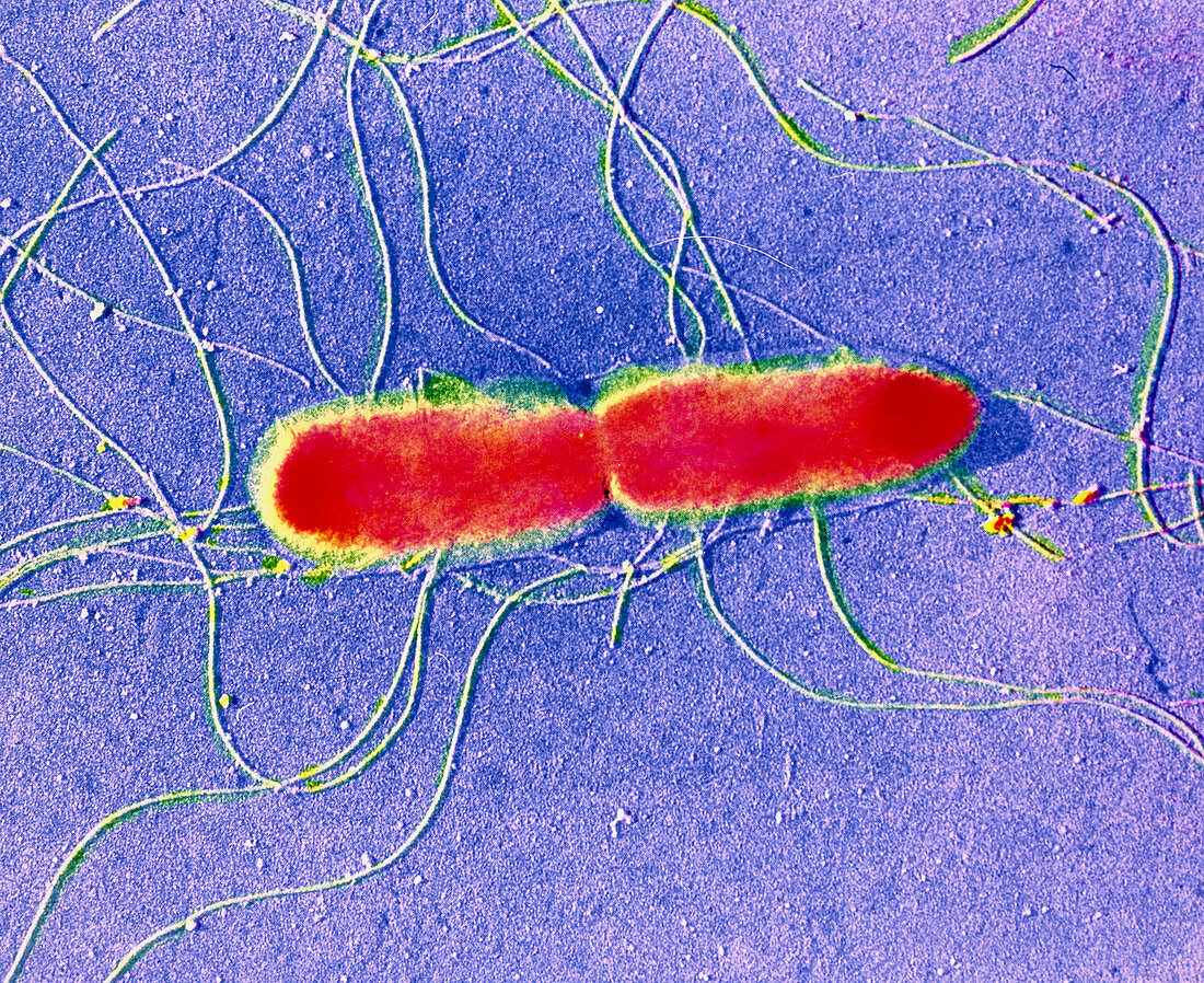 False-colour TEM of Salmonella typhi