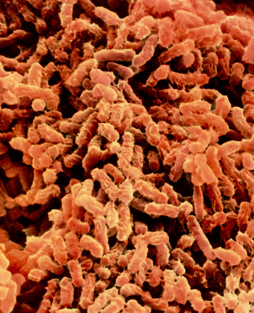 Klebsiella pneumoniae bacteria