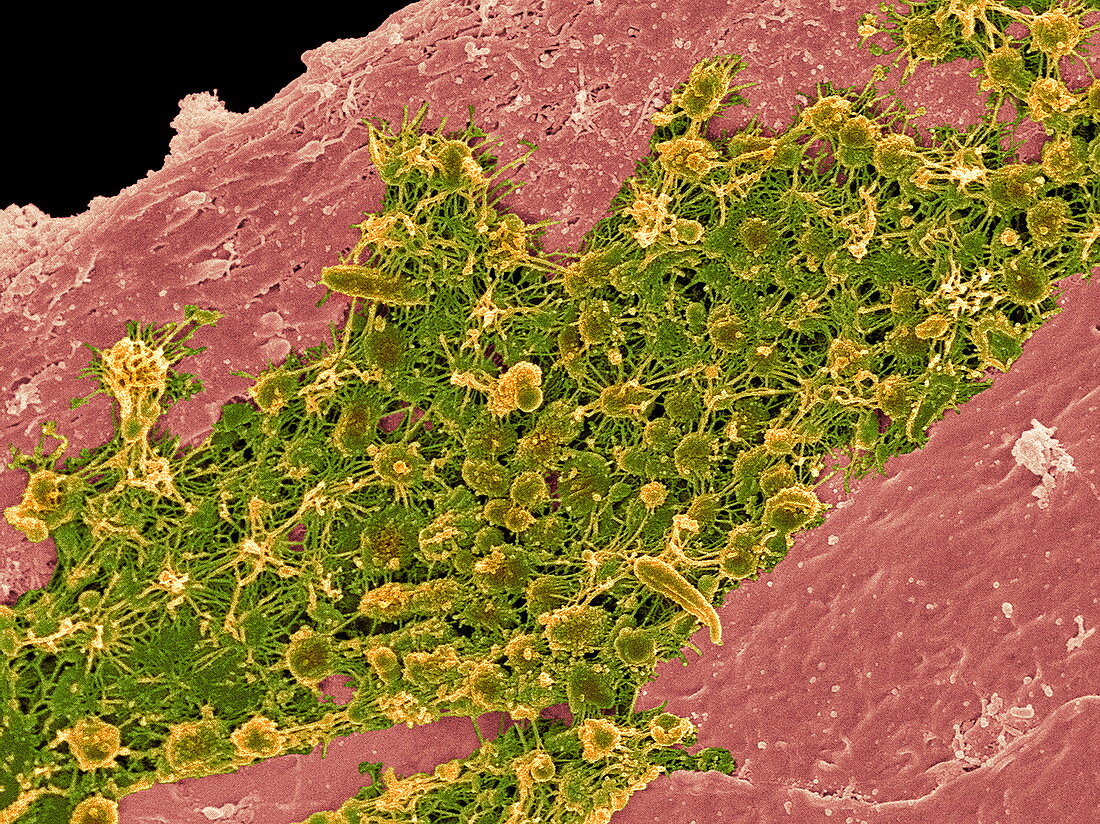 Tongue bacteria,SEM