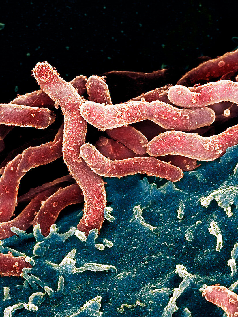 Helicobacter pylori bacteria,SEM