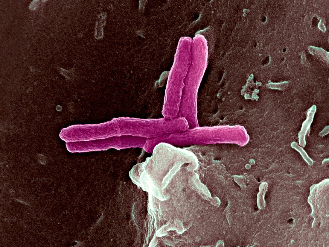 Bacteria infecting a macrophage,SEM