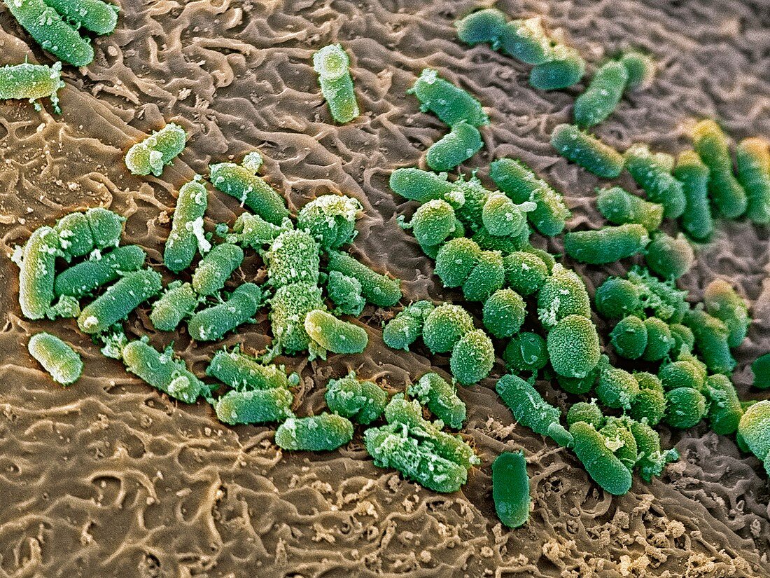 Bacteria in the nose,SEM