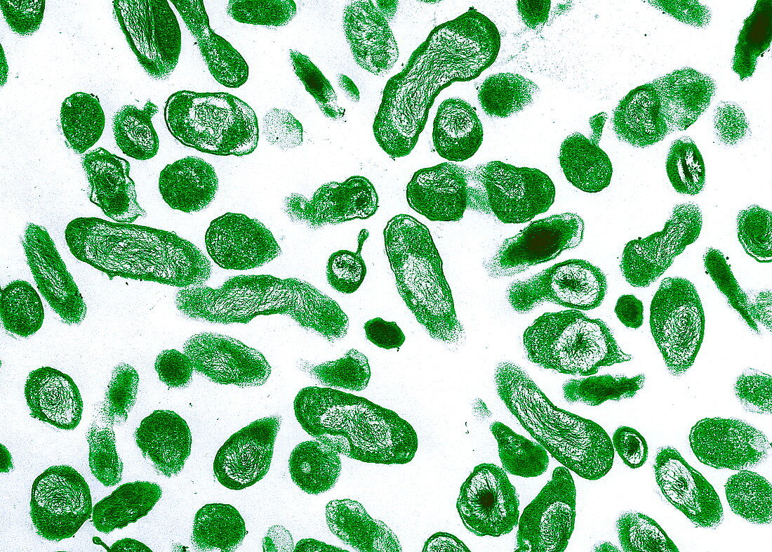 Q fever bacteria,Coxiella burnetii,TEM