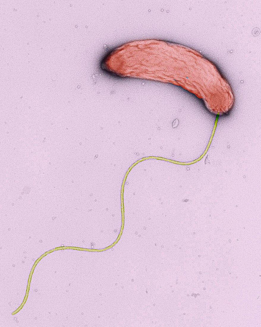 Cholera bacterium,TEM