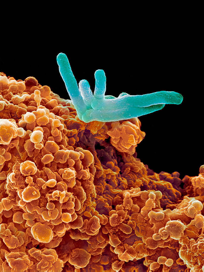 Bacteria infecting a macrophage,SEM