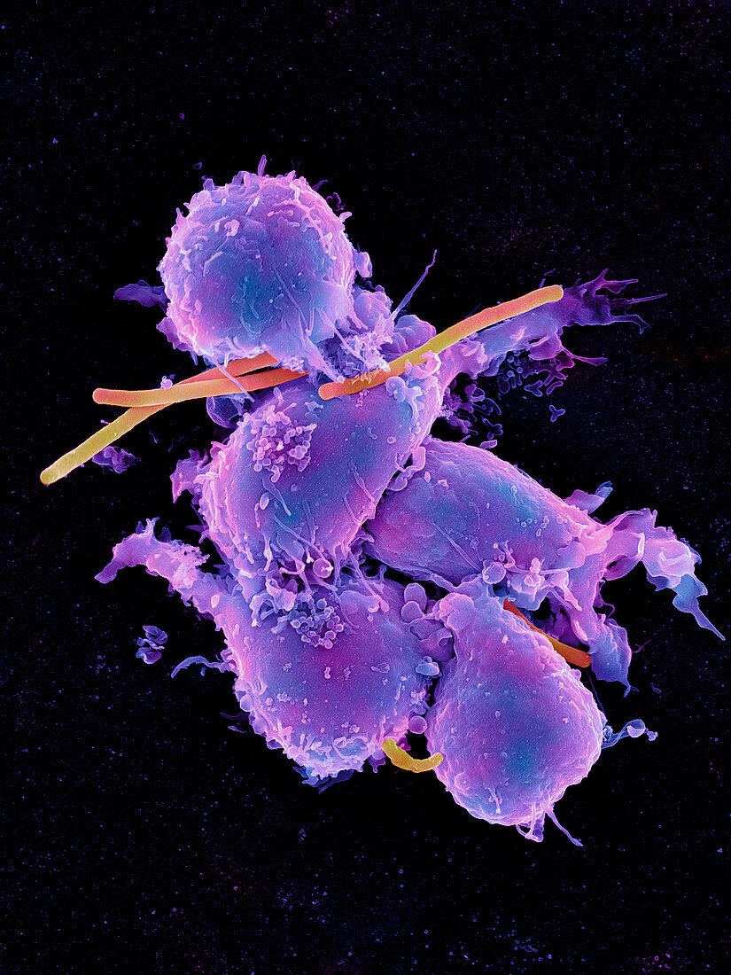 Bacteria infecting macrophage cells,SEM