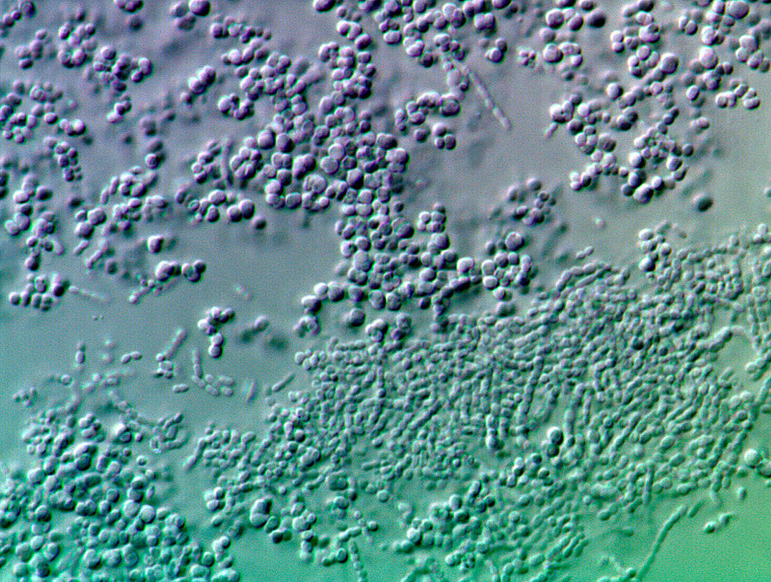Bacterial biofilm,light micrograph