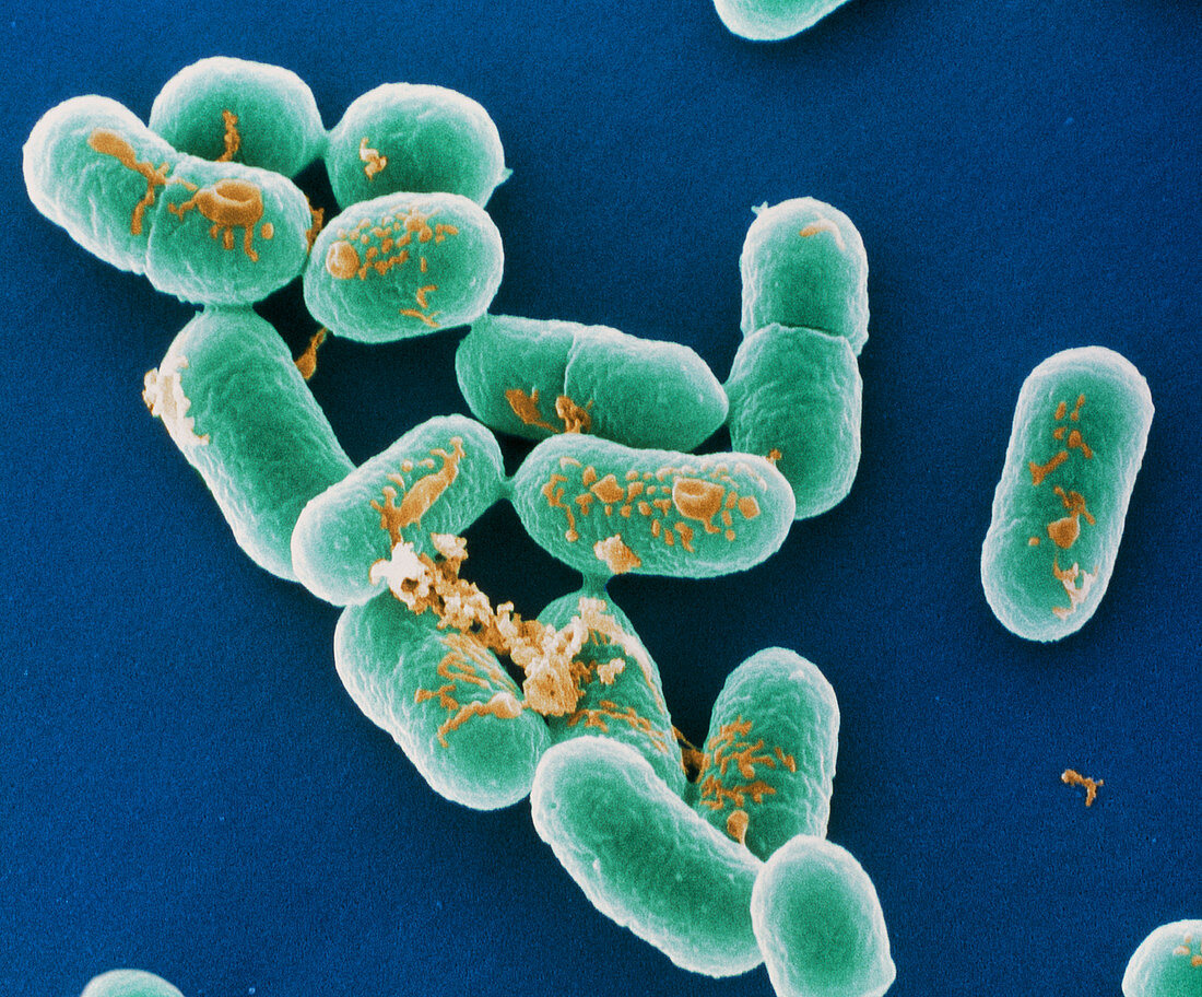 Listeria bacteria,SEM