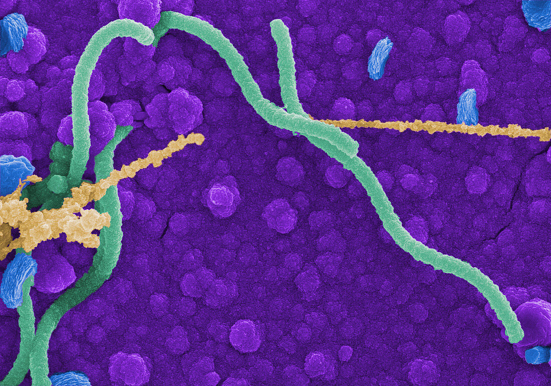 Helicobacter pylori bacteria,SEM