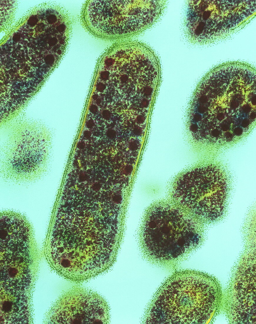 Gardnerella vaginalis bacteria,TEM