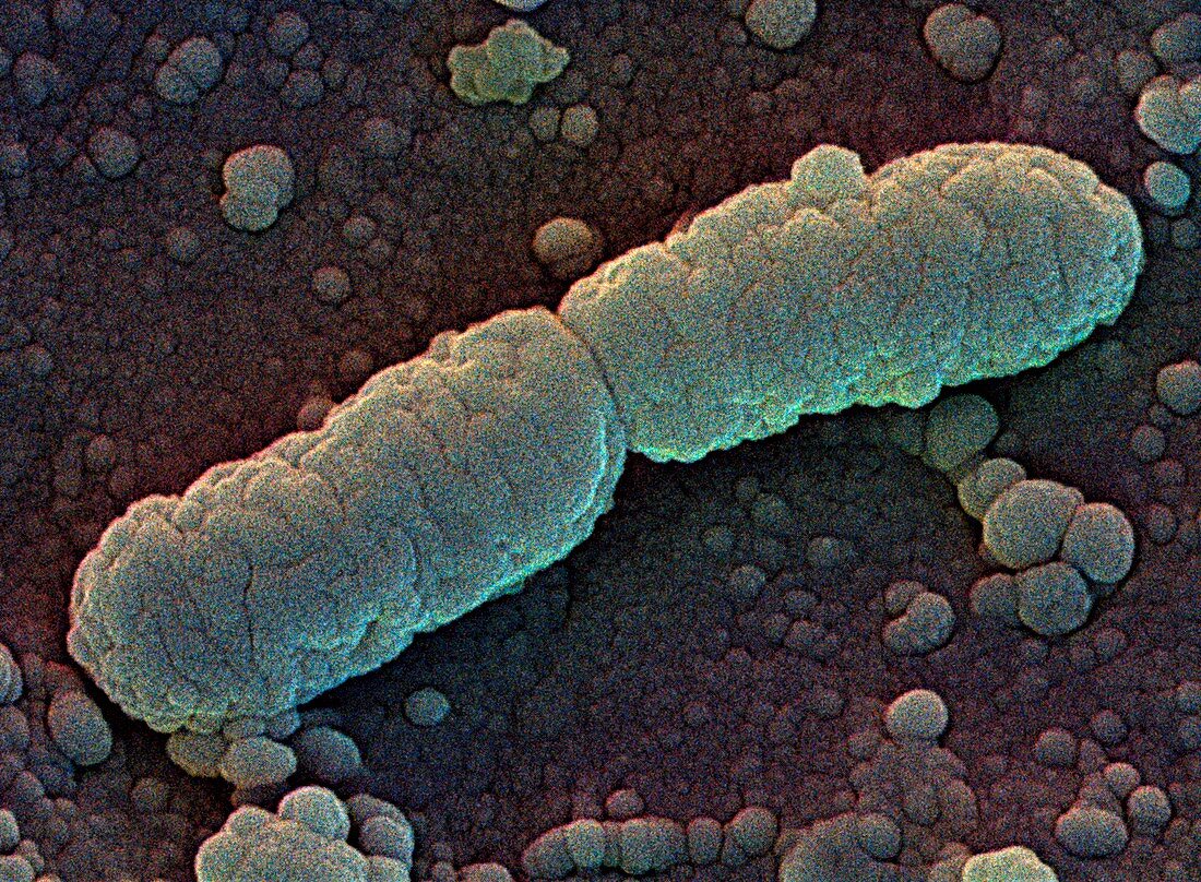 Dividing bacterium,SEM