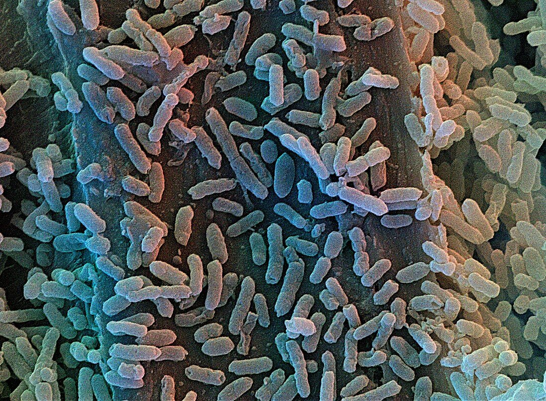 Kitchen bacteria,SEM