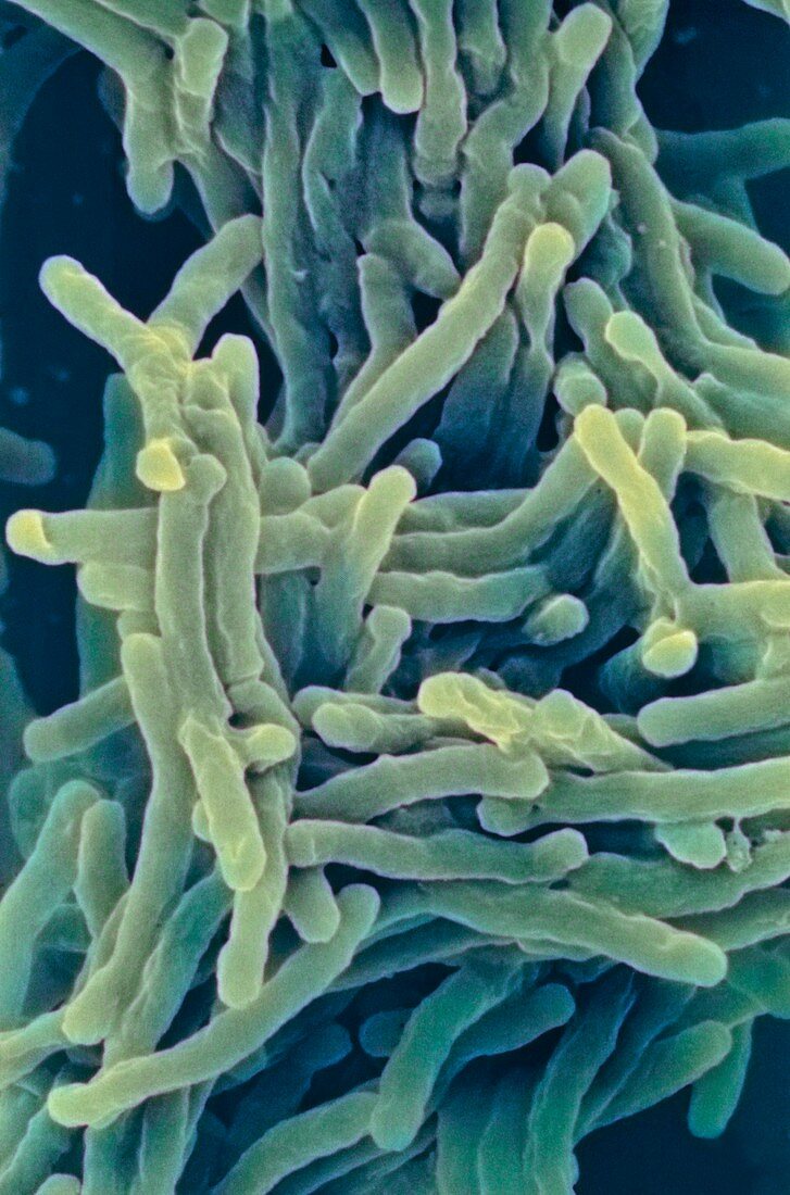 Tuberculosis bacteria,SEM
