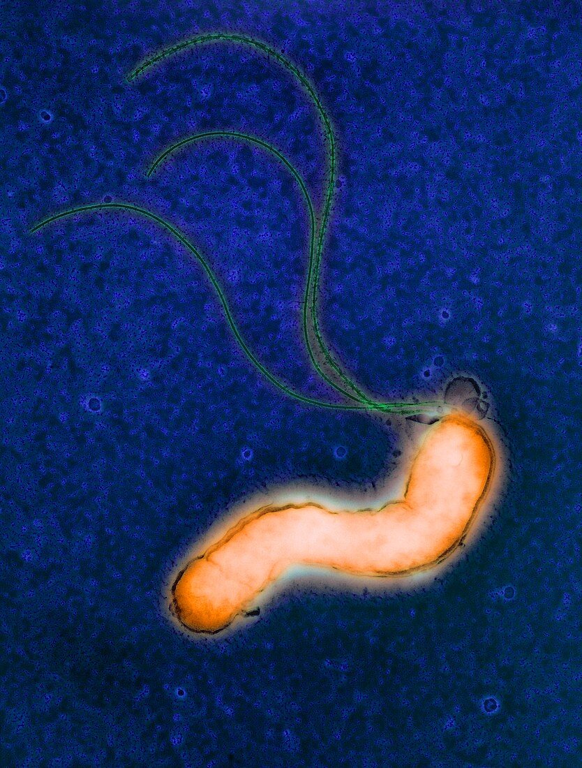 Helicobacter pylori bacterium