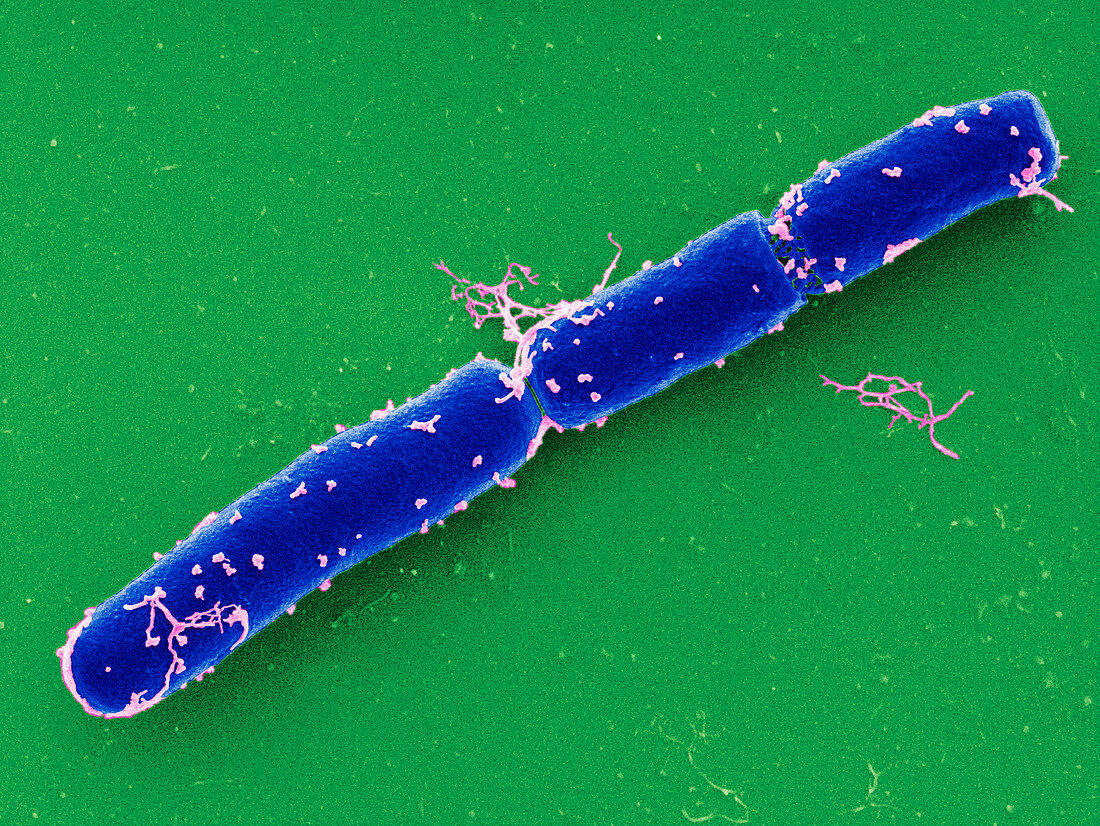 Anthrax bacteria