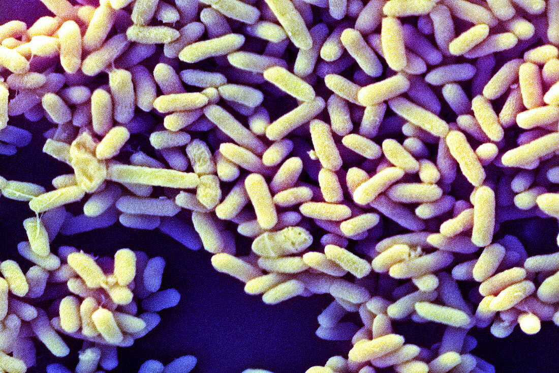 Infant gut bacteria,SEM