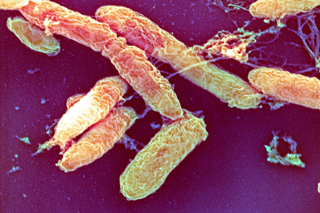 Plague bacteria,SEM