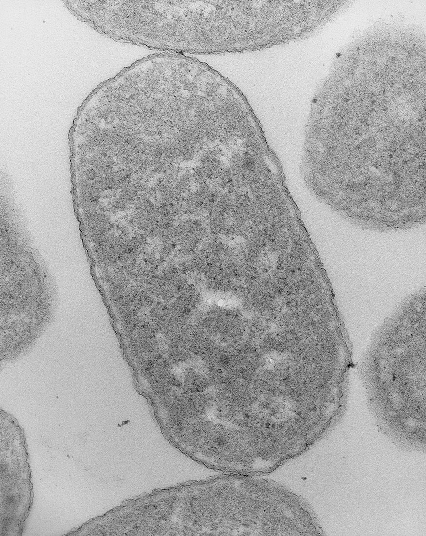 TEM of Escherichia coli 0111 bacteria