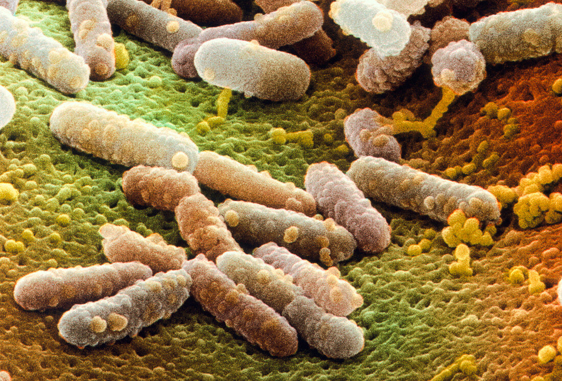 Coloured SEM of Escherichia coli bacteria