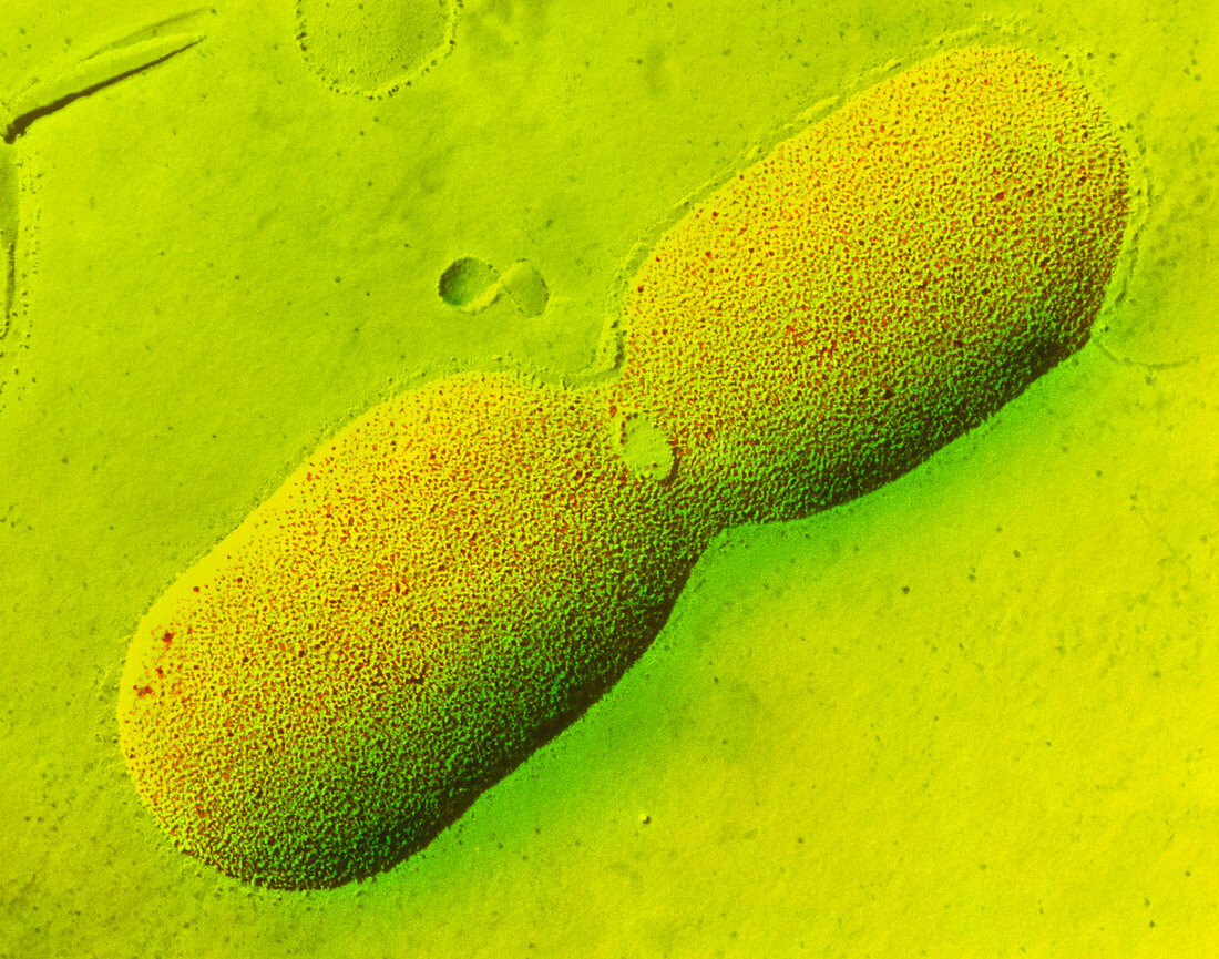 Dividing E. coli bacterium