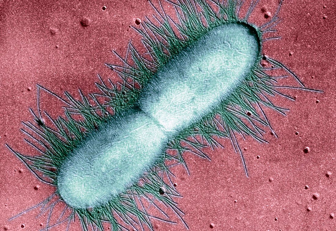 E coli bacterium