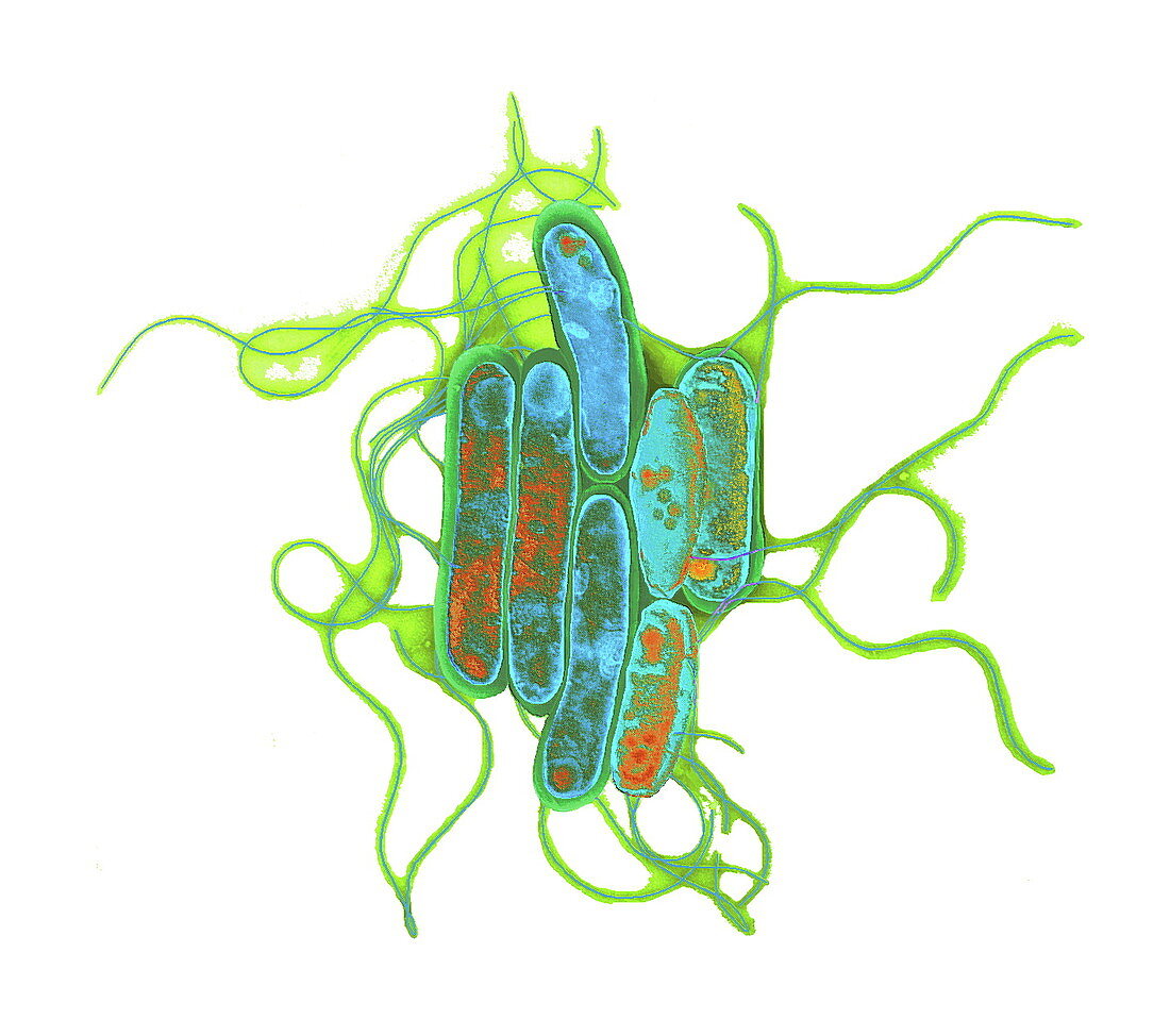 Legionella bacteria