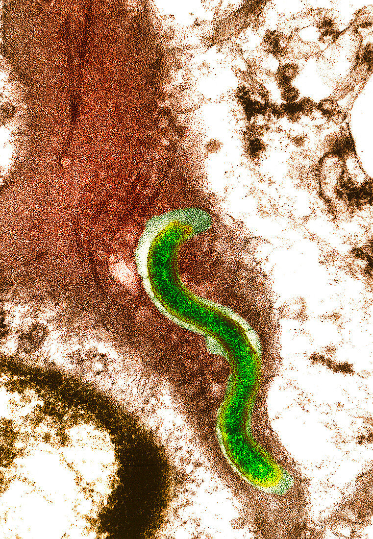 Syphilis bacterium (Treponema pallidum)