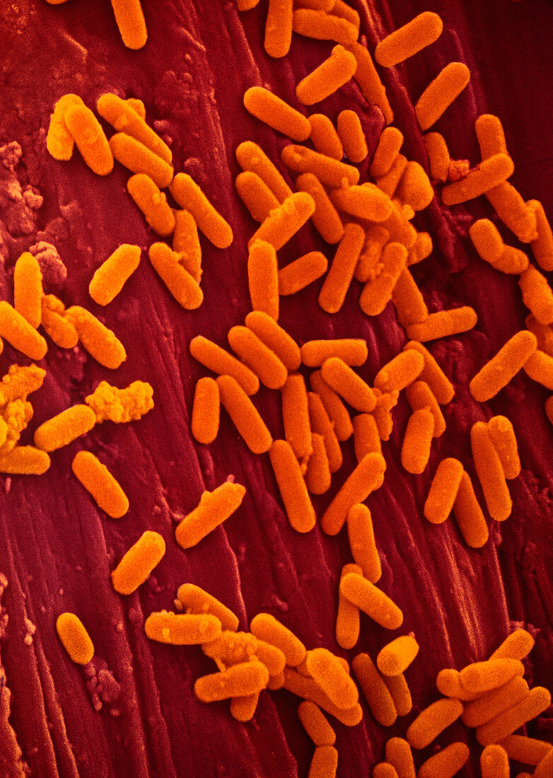 False colour SEM of bacteria on pin