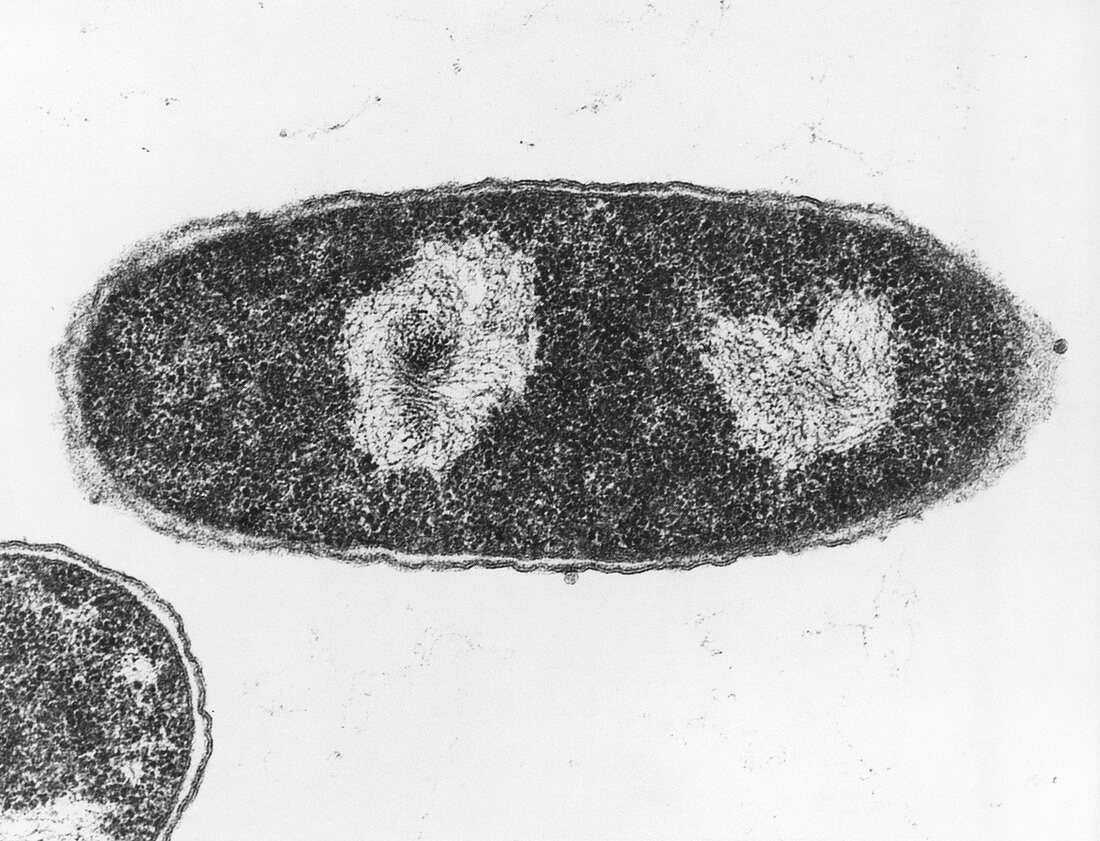 TEM of the bacteria Escherichia coli