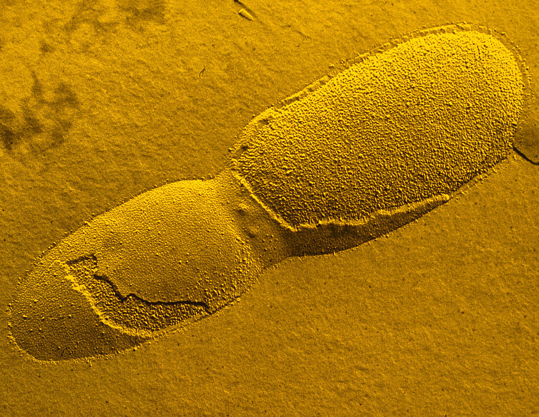 F. col freeze-fracture TEM of E. Coli