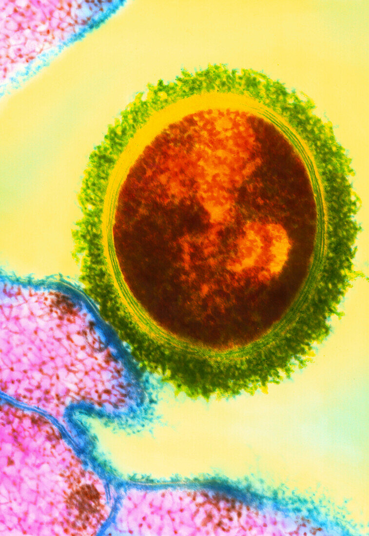 Coloured TEM of Streptococcus bacterium