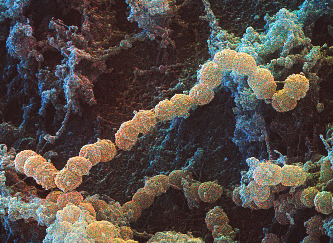 Streptococcus mutans bacteria,SEM