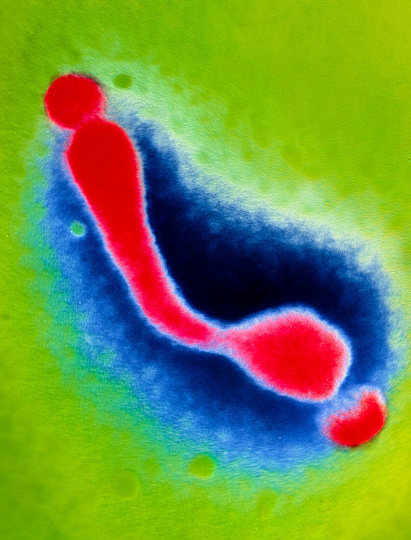 Coloured TEM of Mycoplasma sp
