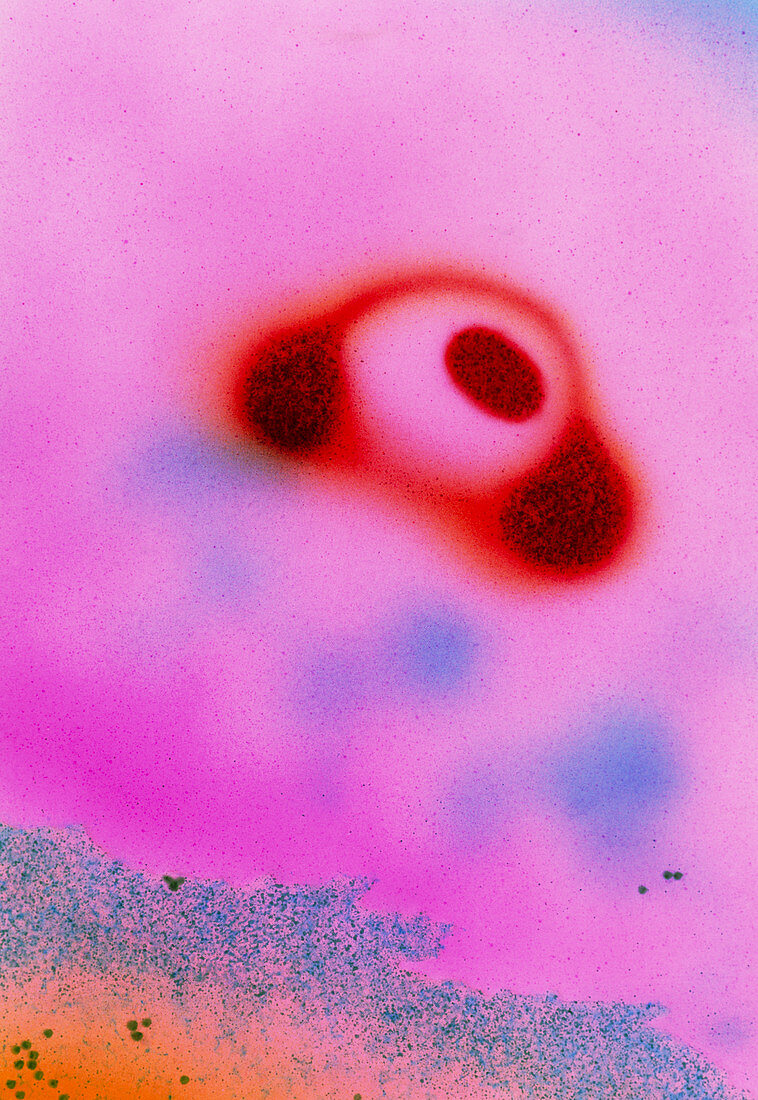 Mycoplasma pneumoniae bacteria