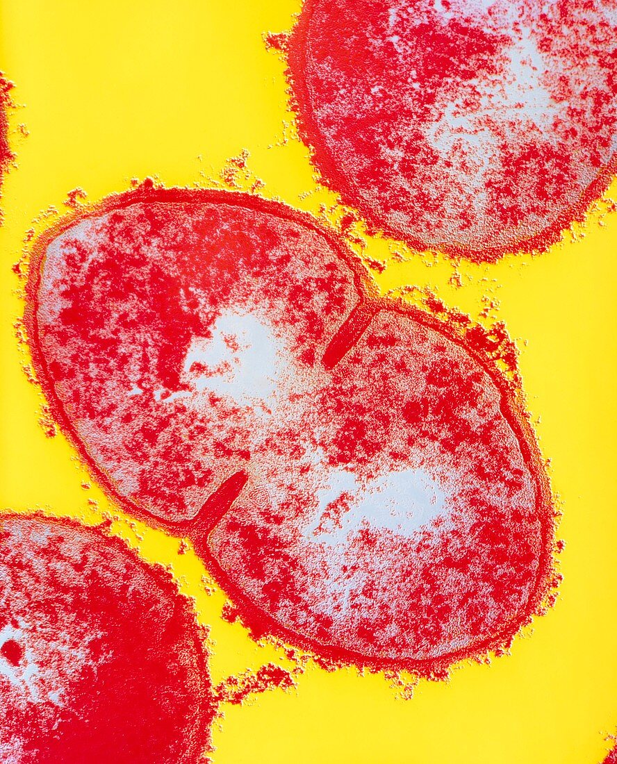 Resistant Streptococcus pyogenes strain