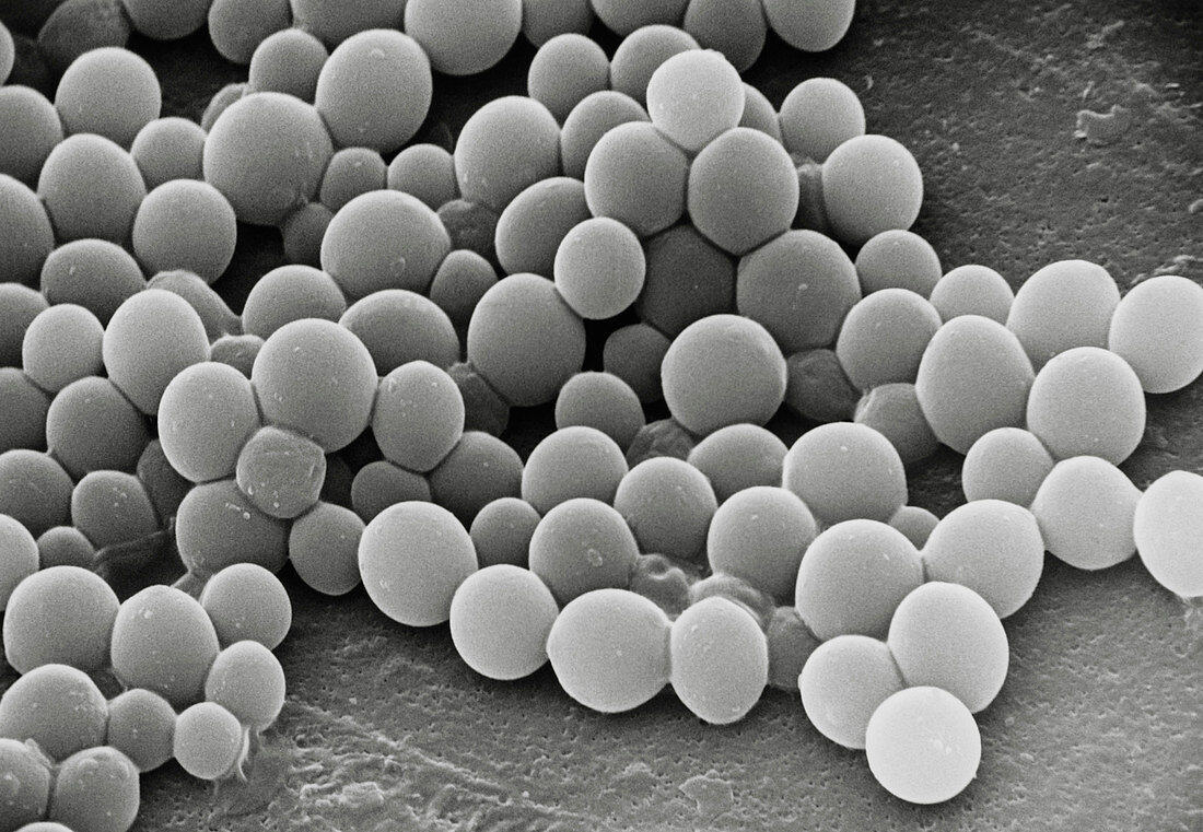 SEM of unidentified yeast cells