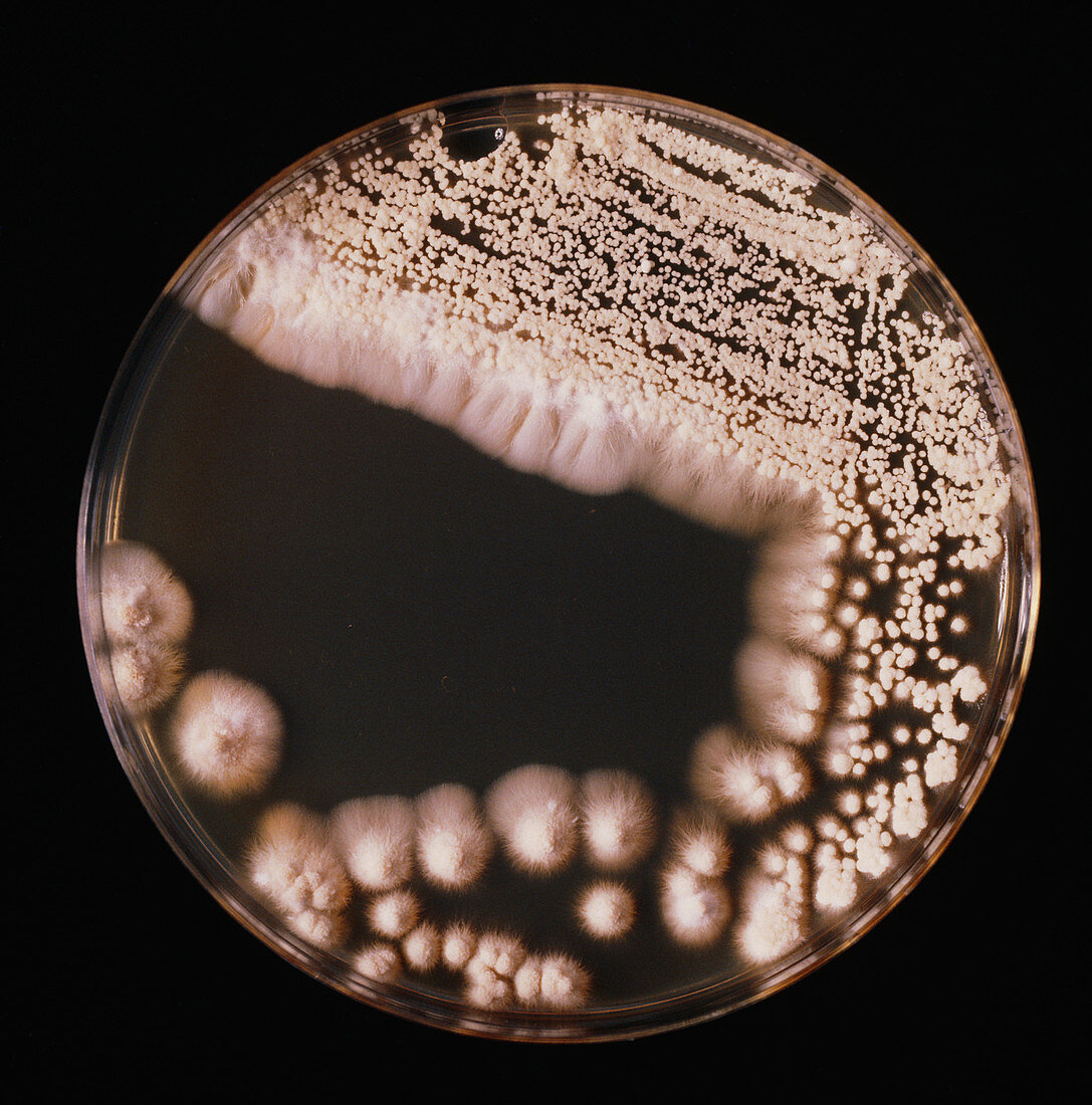 Petri dish of Trichosporon cutaneum