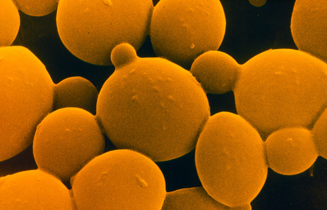 SEM of yeast cells