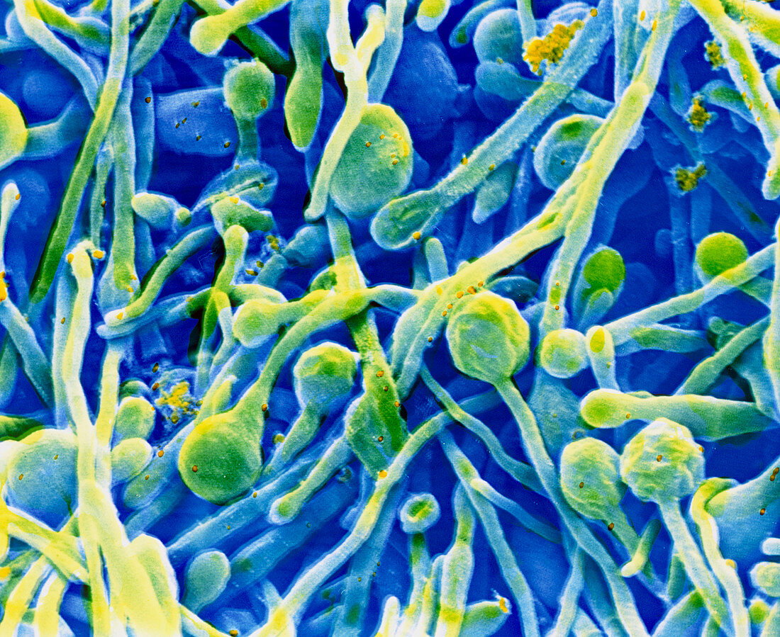 False-colour SEM of fungus: Blastomyces dermatidis