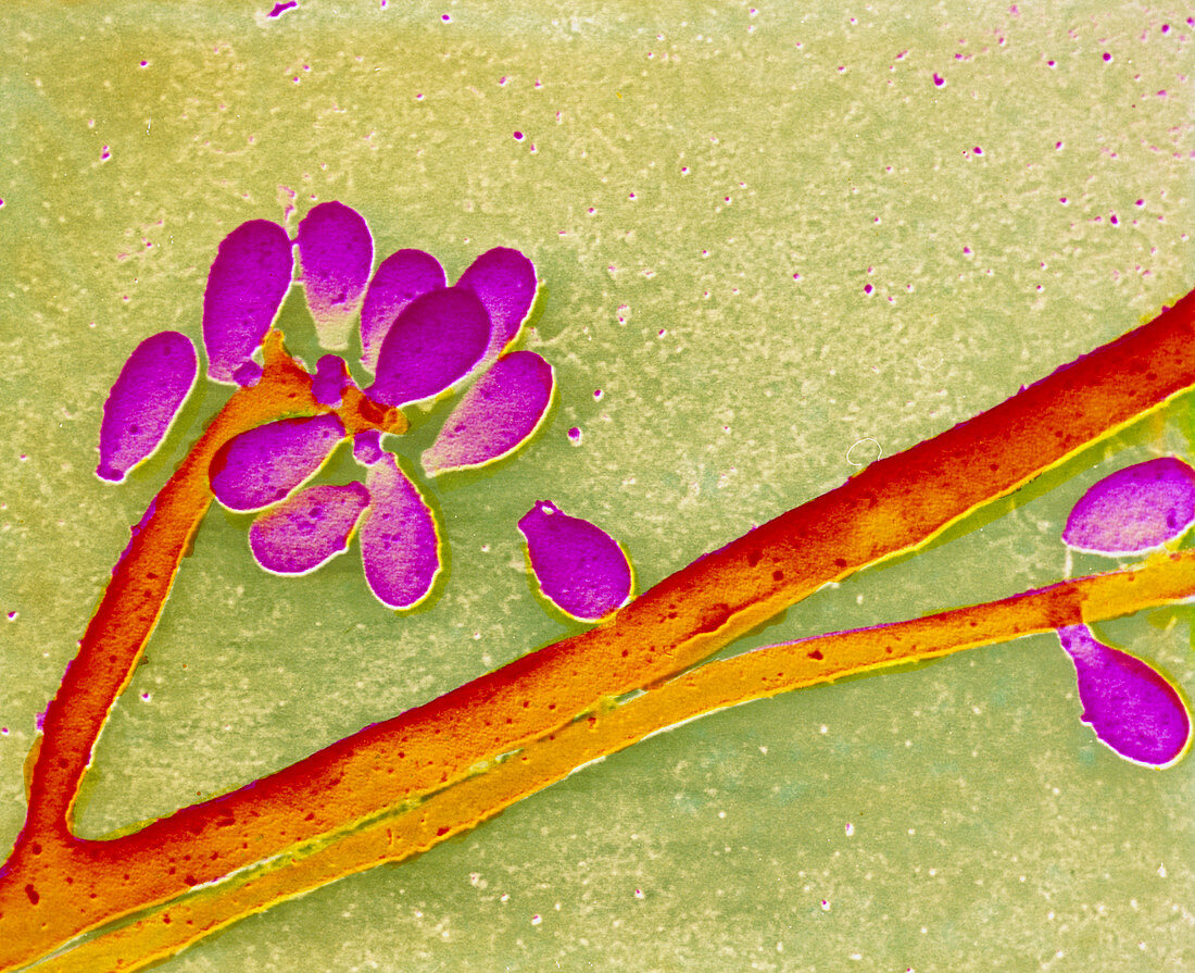 Fungus Sporothrix schenckii