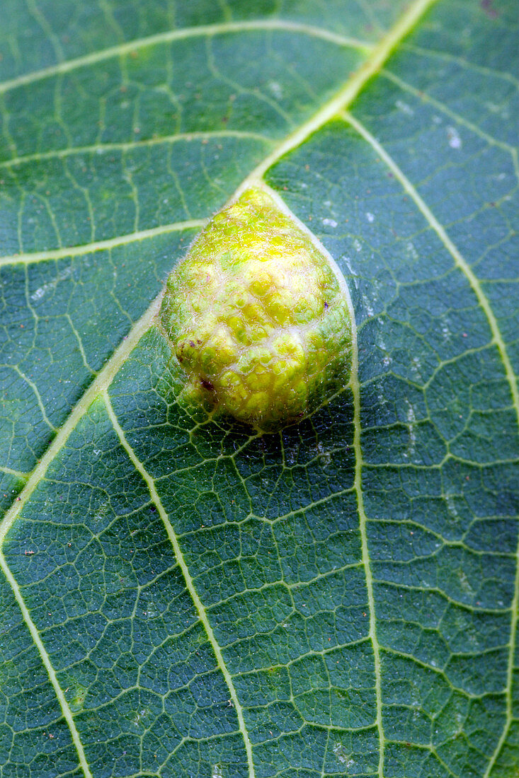 Gall blister